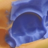Siliconas y geles para condensación dental. Ventura top catalyst - putty - light