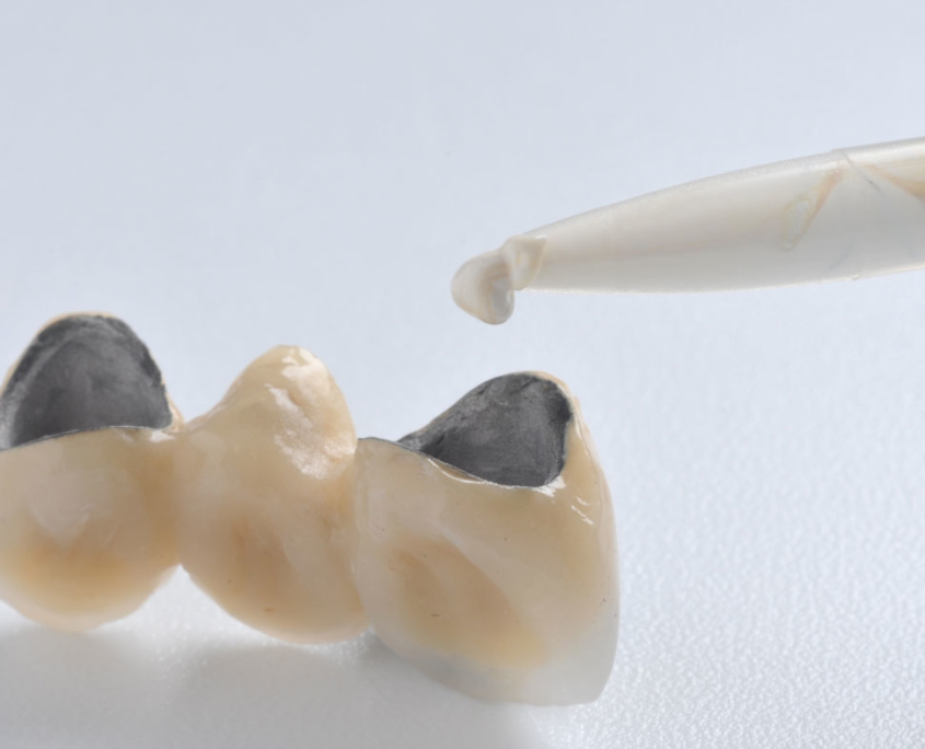 Cemento dental provisional - ventura TempoCem